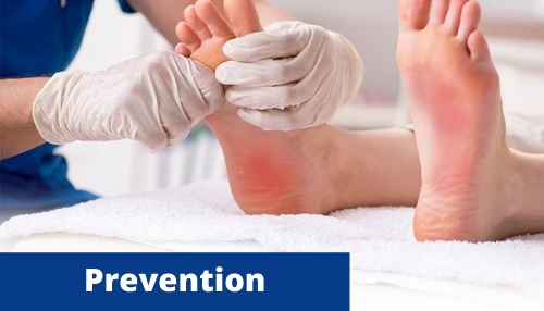 Prevention Foot Surgeon